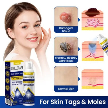 Timilk® ChillErase Bump Renewal Spray